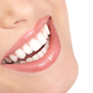 Blanqueamiento Dental – Paquete 3 Sesiones