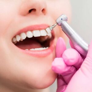 Limpieza Dental Profunda